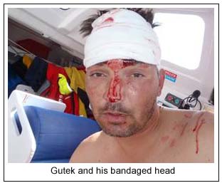 Gutek and his bandaged head